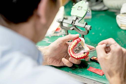デンチャー技工の業務内容